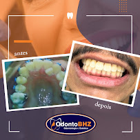 OdontoBHZ- Odontologia e Estética no Centro de BH- UNIDADE RUA ESPÍRITO SANTO