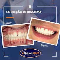 OdontoBHZ- Odontologia e Estética no Centro de BH- UNIDADE RUA ESPÍRITO SANTO