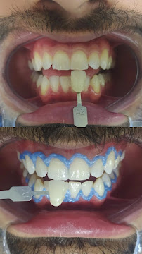 OdontoBHZ- Odontologia e Estética no Centro de BH- UNIDADE RUA ESPÍRITO SANTO