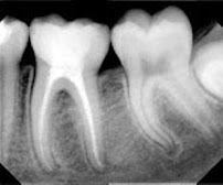 Dental Artex clínica dental Dentistas en Guadalajara zona joyas del nilo