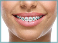 Dental Artex clínica dental Dentistas en Guadalajara zona joyas del nilo