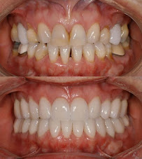 Dental Artex clínica dental Dentistas en Guadalajara zona joyas del nilo in Guadalajara, Mexico