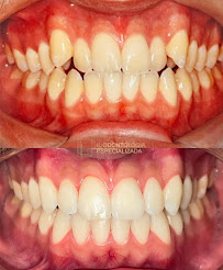 Dentista no Barreiro | IL Odontologia Especializada