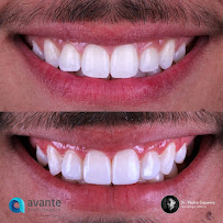 Avante Odontologia - Unidade BH