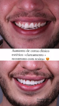 Avante Odontologia - Unidade BH
