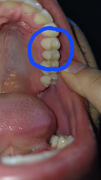 Dental Prime