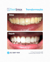 DentSmax - Clínica Odontológica