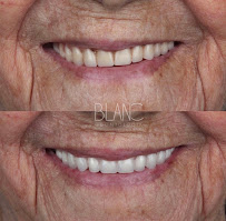 BLANC Clínica Odontológica