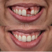 BLANC Clínica Odontológica