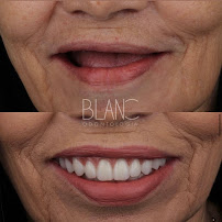 BLANC Clínica Odontológica