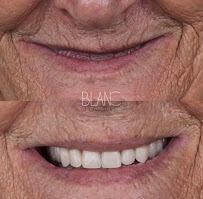 BLANC Clínica Odontológica