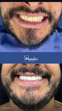 Mendes Odontologia