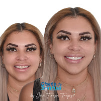 Diseño de Sonrisa