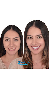 Diseño de Sonrisa