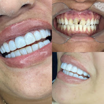 Sorriso Prime - Dentista em Manaus