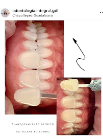 Dental Glow