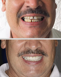 Dental Glow