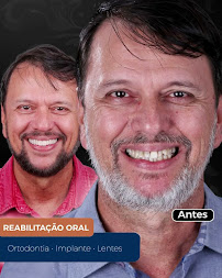 DentiFy Odontologia | Dra. Cláudia Diniz | Dentista em Manaus | Implante Dentário | Lentes | +30 anos de Experiência