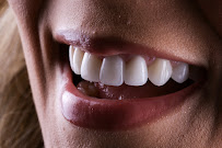 DentiFy Odontologia | Dra. Cláudia Diniz | Dentista em Manaus | Implante Dentário | Lentes | +30 anos de Experiência