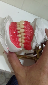 Dentista Manaus - Dra Irla Thaís - Prótese Dentária