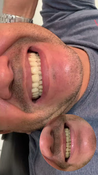 Dentista Manaus - Dra Irla Thaís - Prótese Dentária