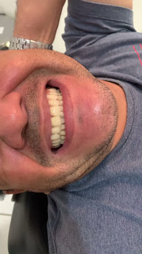 Dentista Manaus - Dra Irla Thaís - Prótese Dentária