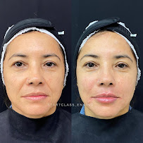 Dra. Monique Batista - Especialista em Implantes Dentários em Manaus