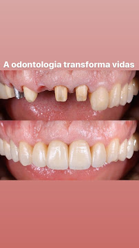 Dra Adriane Andrade - Lentes e Facetas