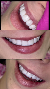 Dra Adriane Andrade - Lentes e Facetas