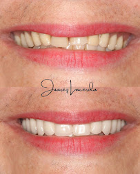 Odonto Amazon - Implantes, Prótese, Endo e Ortodontia