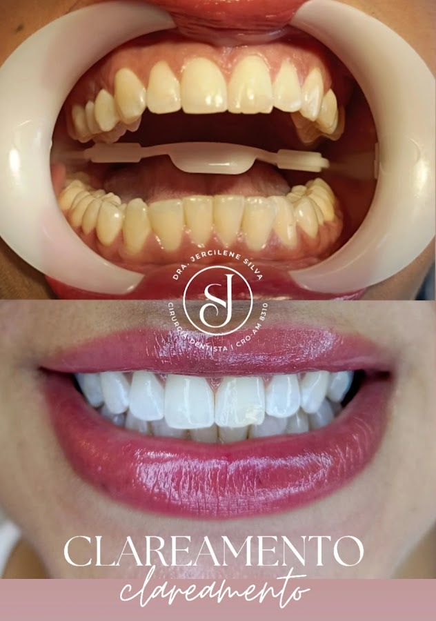 Dra. Jercilene Silva - Clínica Odontológica - dental clinic in Manaus, Brazil