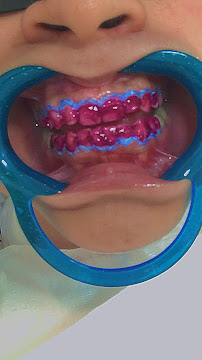 Dra. Jercilene Silva - Clínica Odontológica