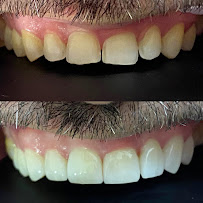 Dentista en Guadalajara Buco Dent