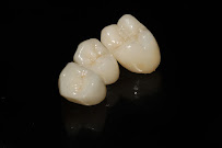 Dentista en Guadalajara Buco Dent