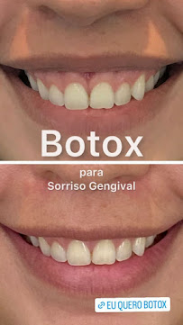 Fibro Odontologia