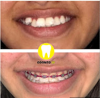 Odonto SF - DENTISTAS