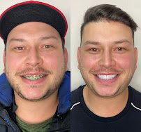 Dental Max