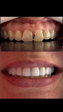 Dental Max