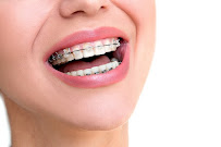 Clínica de Odontologia e Ortodontia - De Boca Aberta