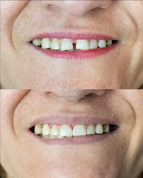 ConnectOdonto Curitiba | Implante Dentário | Dentista em Curitiba PR | Clínica Odontológica