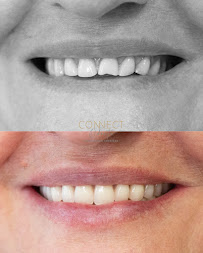 ConnectOdonto Curitiba | Implante Dentário | Dentista em Curitiba PR | Clínica Odontológica