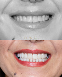 ConnectOdonto Curitiba | Implante Dentário | Dentista em Curitiba PR | Clínica Odontológica in Curitiba