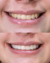 ConnectOdonto Curitiba | Implante Dentário | Dentista em Curitiba PR | Clínica Odontológica