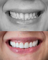 ConnectOdonto Curitiba | Implante Dentário | Dentista em Curitiba PR | Clínica Odontológica
