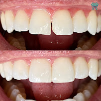 Ortovitalli Odontologia - Clinica de Implantes | Próteses | Lentes e Facetas