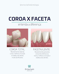 Ortovitalli Odontologia - Clinica de Implantes | Próteses | Lentes e Facetas