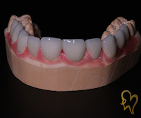 Diseño de Sonrisa en Guadalajara Dra Luly Mata Dentista