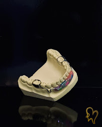Diseño de Sonrisa en Guadalajara Dra Luly Mata Dentista