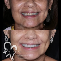 Diseño de Sonrisa en Guadalajara Dra Luly Mata Dentista