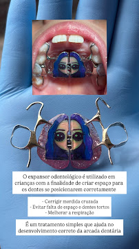 Clarear Odontologia - Especialista em Endodontia